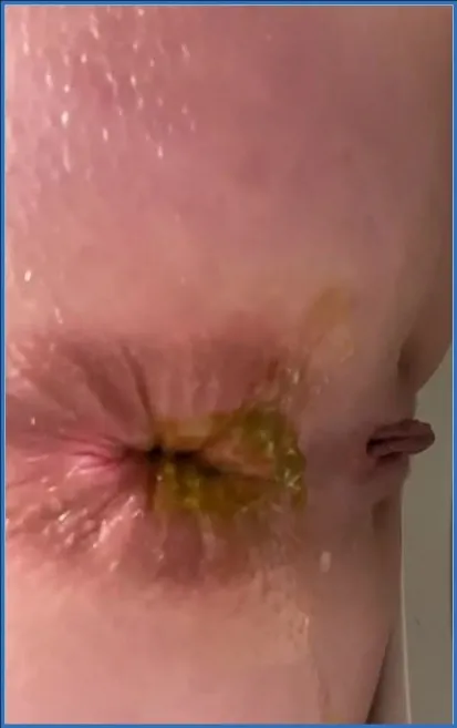 Kaviar Fetish with Foxness: Pooping - scat porn video at ScatSlave.net