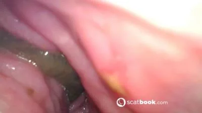 Scatbook (Sweet Tinqerbell) - Endoscope In My Ass [FullHD 1080p] (Gaping, Dildo)