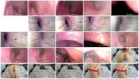 Scatbook (Sweet Tinqerbell) - Endoscope In My Ass [FullHD 1080p] (647 MB) - ScatSlave