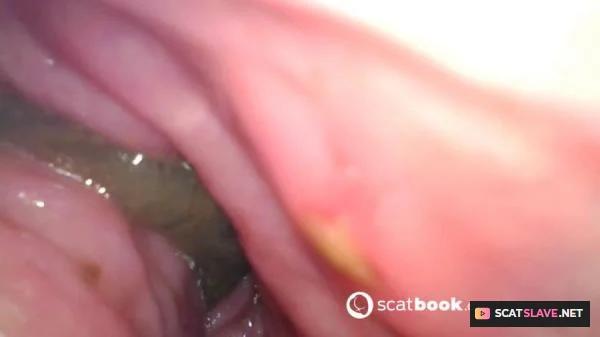 Scatbook (Sweet Tinqerbell) - Endoscope In My Ass [FullHD 1080p] (647 MB)