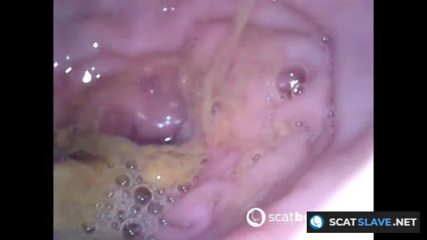 Scatbook.com - Show Inside Of My Ass With Endoscope [FullHD 1080p] 378 MB