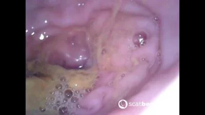 Scatbook.com - Show Inside Of My Ass With Endoscope [FullHD 1080p] 378 MB